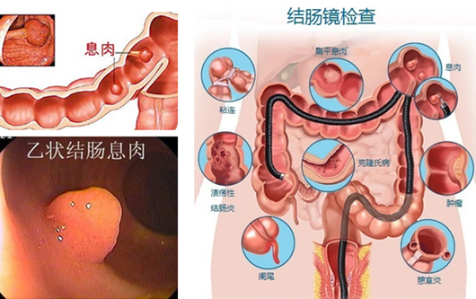 萎縮性胃炎真的“很嚇人”？看完這“七個(gè)事實(shí)”你就明白了